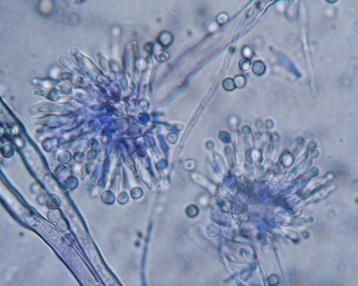 Aspergillus