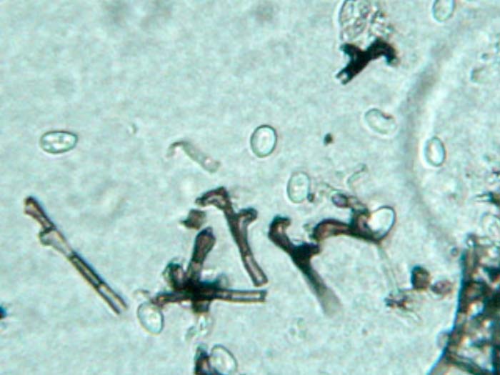 Zygosporium