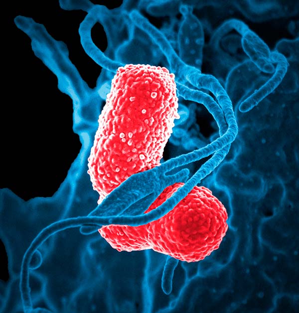 Fusobacterium nucleaum