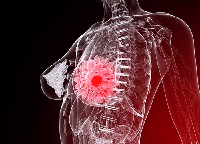 proteína MSK1portada