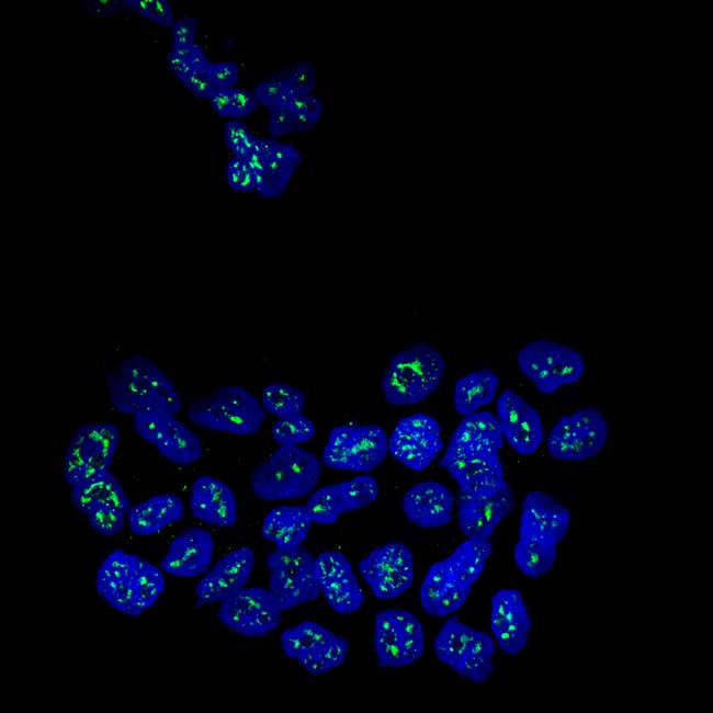 proteína MSK1