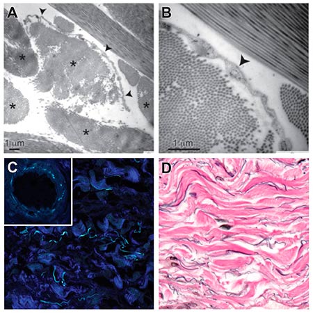 imagenes microscopio intersticio