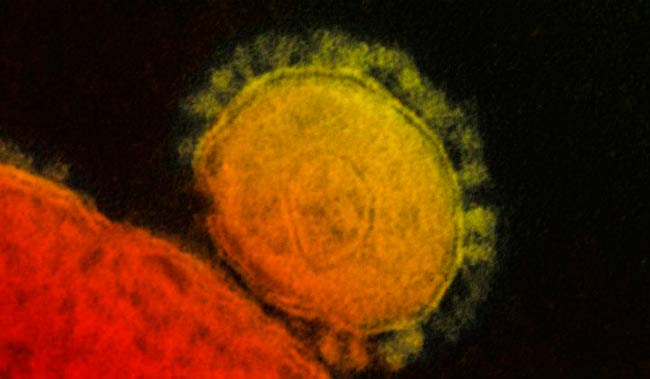 coronavirus 2019nCoV