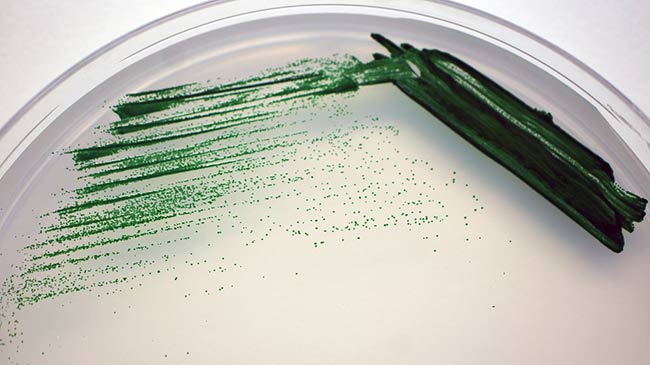 cianobacterias en placa de agar