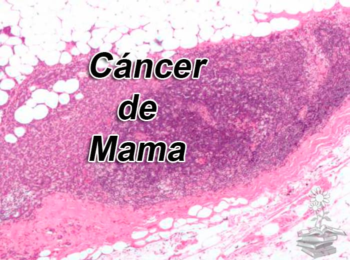 eliminaron el cancer de mama con un autotransplante portada