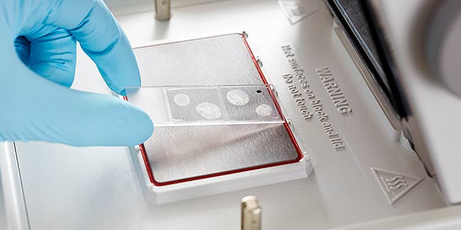 PCR in situ