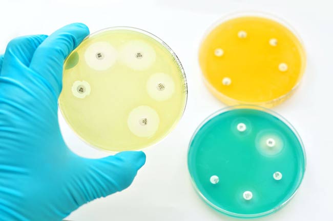 resistencia bacterias bajo antibioticos