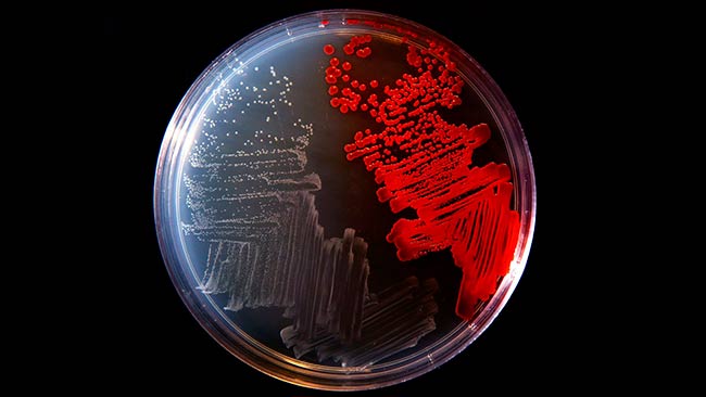 aislamiento cultivo de bacterias