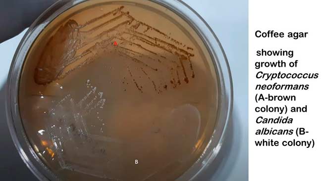 Candida albicans y Cryptococcus neoformans