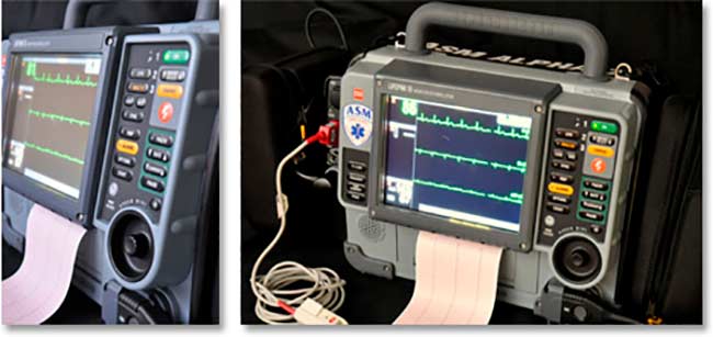 metodos aprendizaje automatico del sindrome coronario agudo para ECG 12 derivaciones