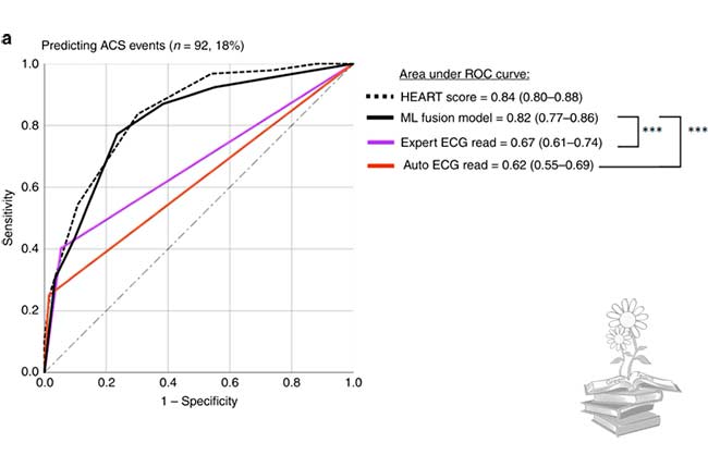 clasificadores de aprendizaje automático superan a los médicos expertos y a los algoritmos de ECG comerciales en la detecciónde SCA