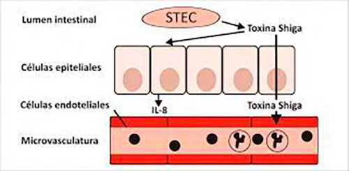  toxina Shiga de Escherichia coli enterohemorrágica 