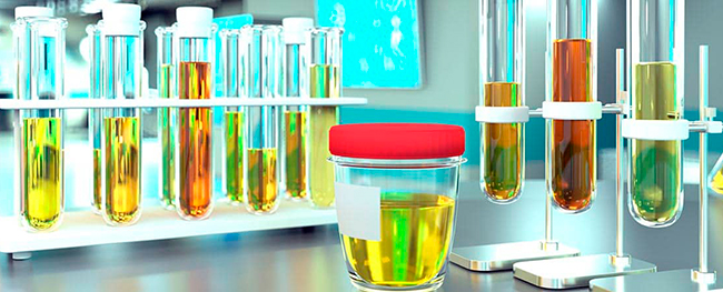 cultivo urinario en laboratorio