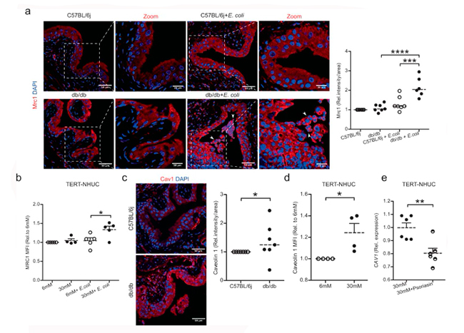 Figura 4 estudio infeccion de orina derivada de la diabetes, glucosa e infeccion E.coli modulan proteina membrana