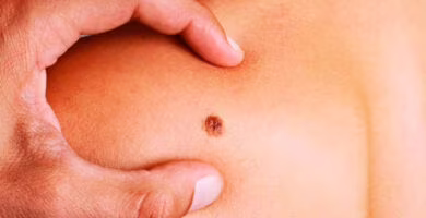 triple terapia para detener el melanoma avanzado portada