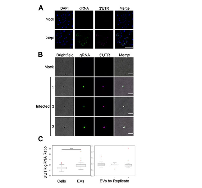 Figura 3 del estudio de ARN antiinmune del dengue