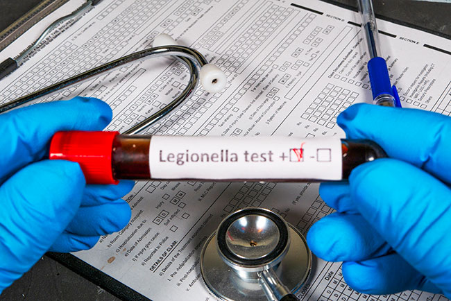 control y prevención de Legionella