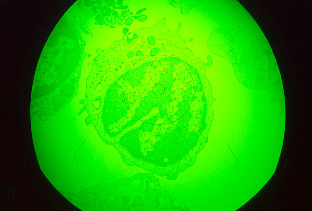 virus de la peste porcina africana