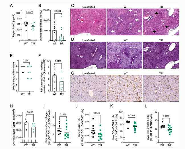 Figura 7 del estudio sobre el papel del hierro en las celulas del hospedador de malaria