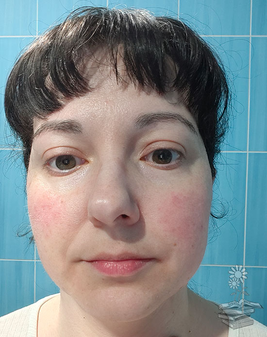 rostro con el tónico calmante de mádara aplicado