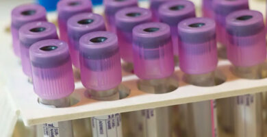 test de sangre que detecta el Alzhéimer portada