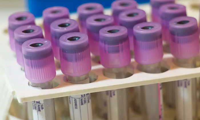 test de sangre que detecta el Alzhéimer portada